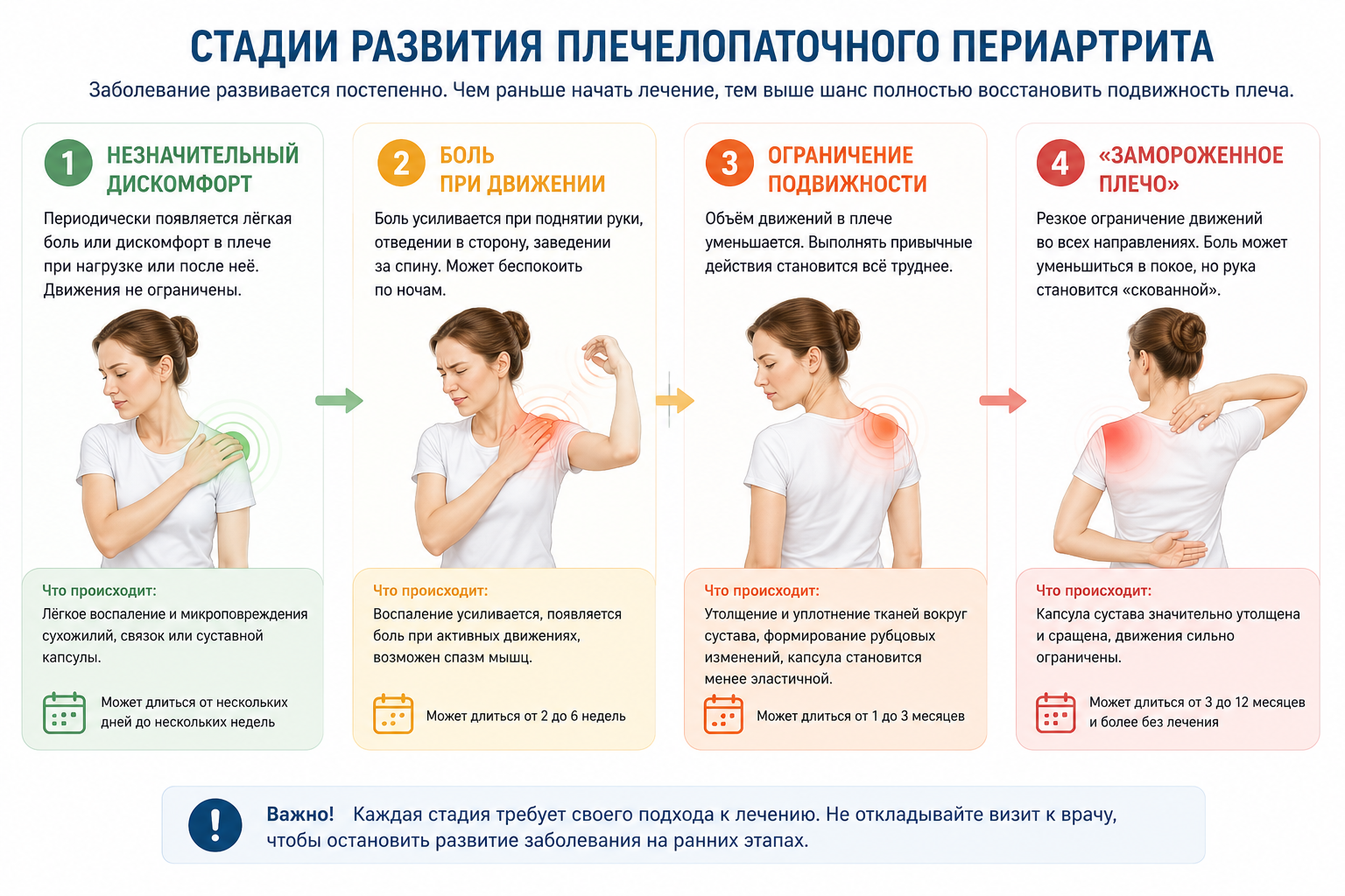 Стадии развития плечелопаточного периартрита - гель Димексид